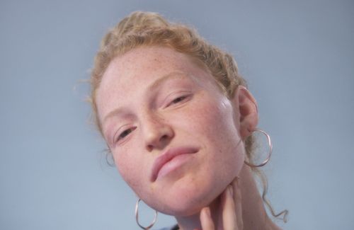 products to remove dark spots caused by pimples